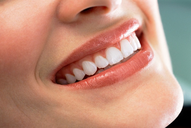 How Ceramic Veneers Work?