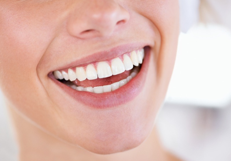 Thinking About Veneers? Here’s the Step-by-Step Porcelain Veneer ProcessBy Dr. Tang | Lansdowne Dental Centre