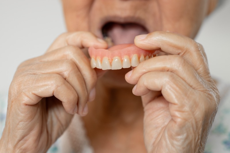 What Is a Denture? A Cost-Effective Way to Replace Missing Teeth