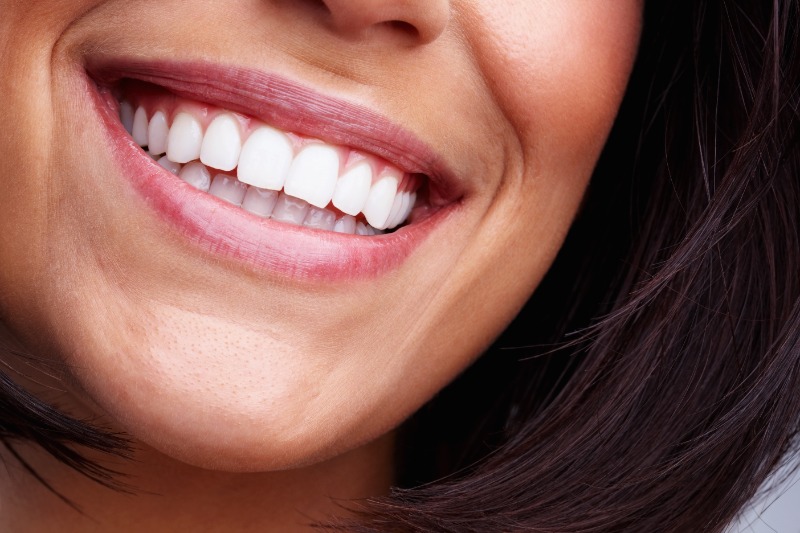 Veneers vs. Crowns: Understanding Your Cosmetic Dentistry Options