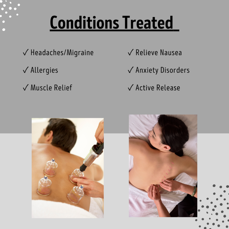 Acupuncture Services Available